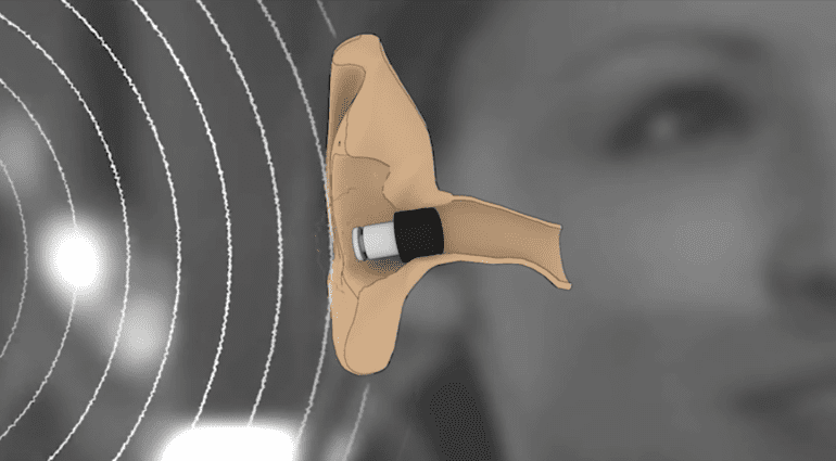 Flare Audio Isolate MiNi - Gehörschutz jetzt auch in klein